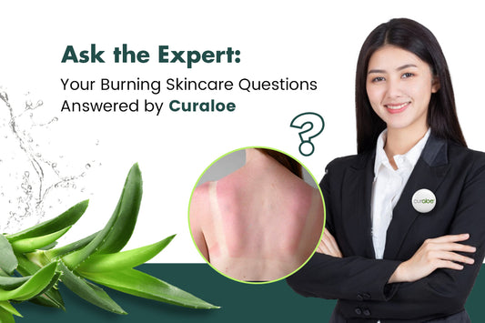 Ask the Expert: Your Burning Skincare Questions Answered by Curaloe