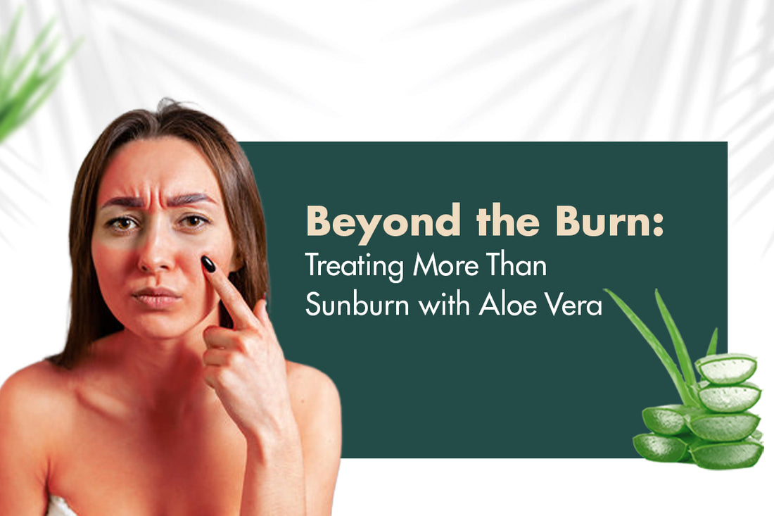 Beyond the Burn: Treating More Than Sunburn with Aloe Vera