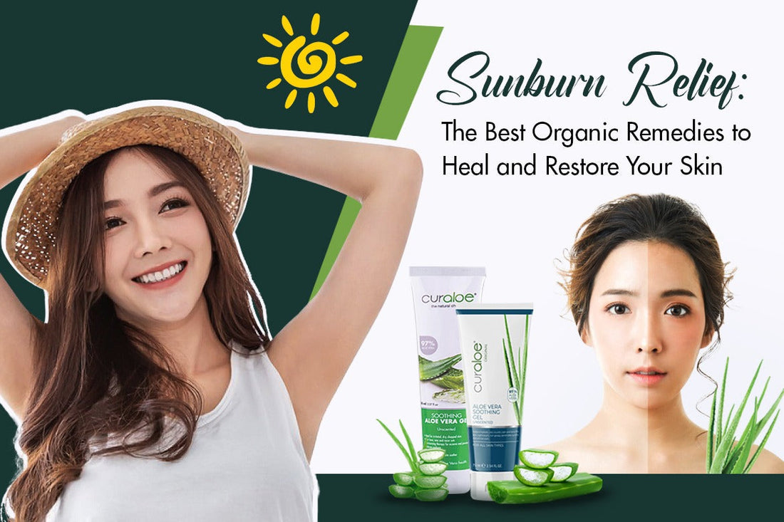 Sunburn Relief The Best Organic Remedies to Heal and Restore Your Skin