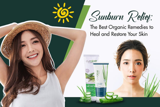 Sunburn Relief The Best Organic Remedies to Heal and Restore Your Skin