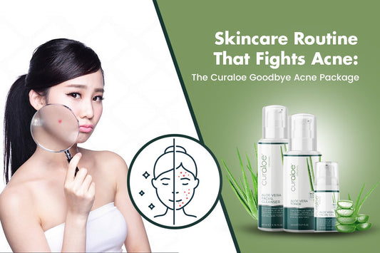Skincare Routine That Fights Acne: The Curaloe Goodbye Acne Package 